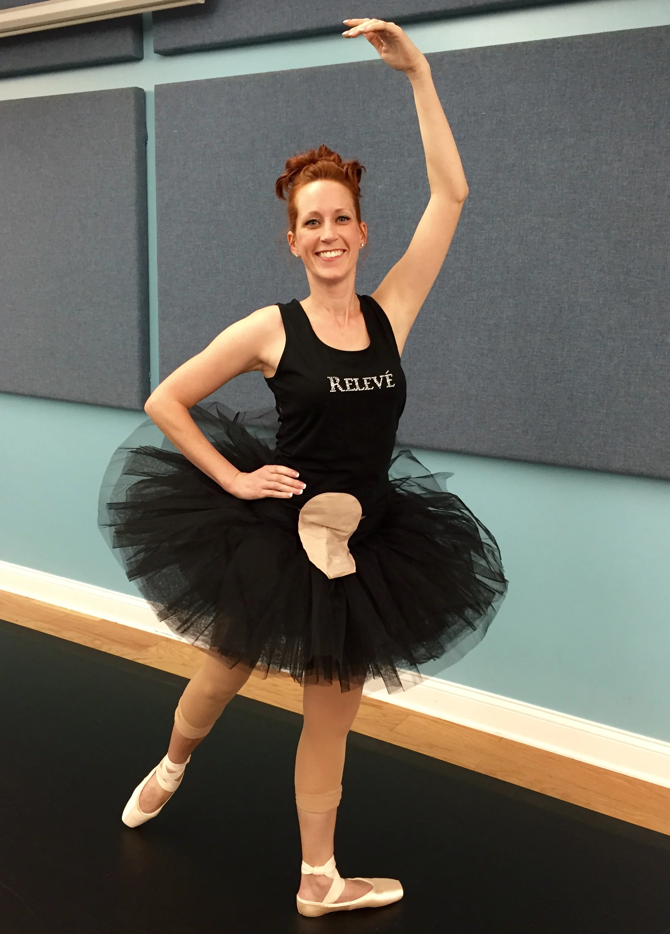 woman wearing an ostomy pouch posing during ballet