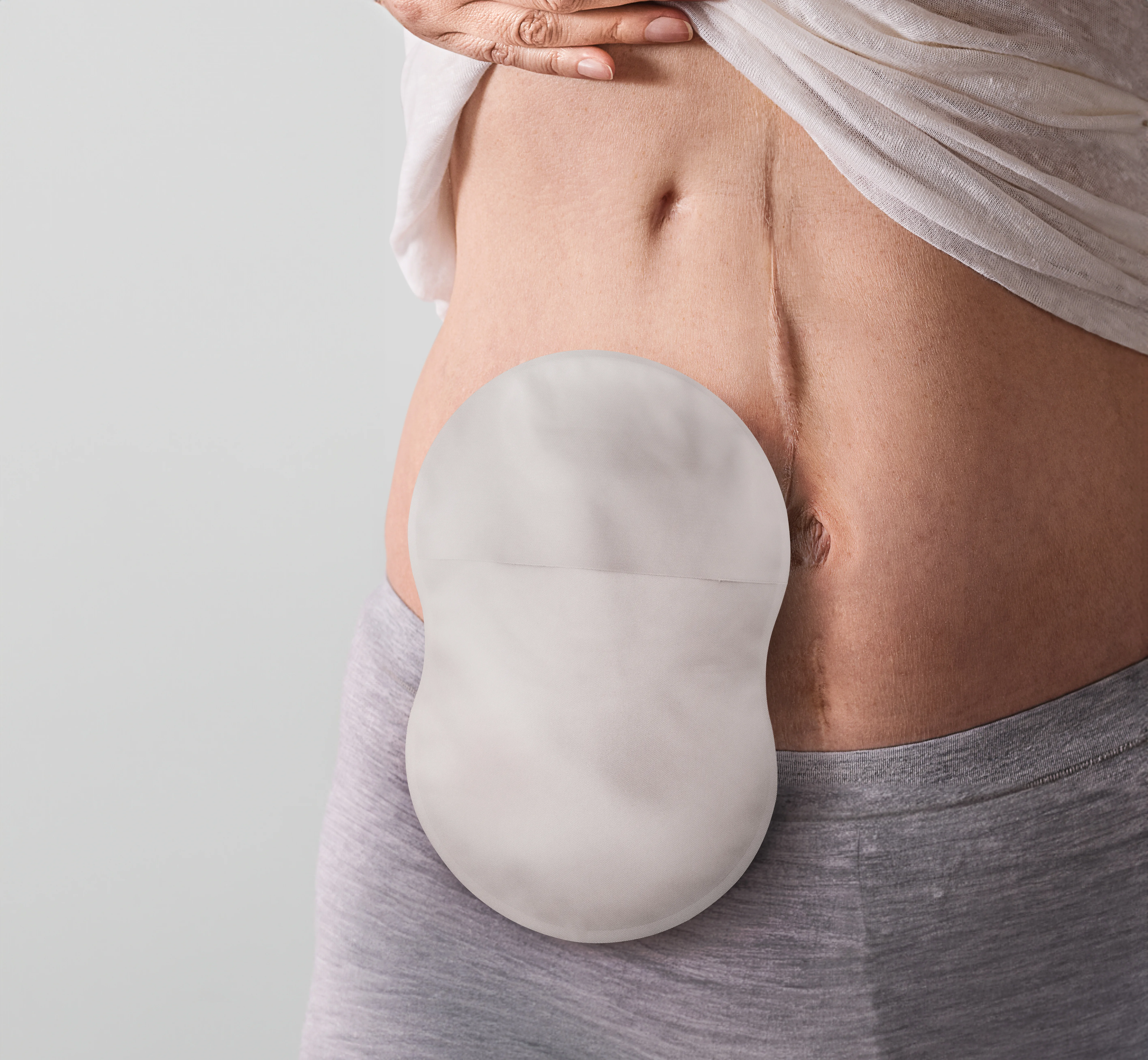 mulher usando uma bolsa de ostomia Esteem Body™