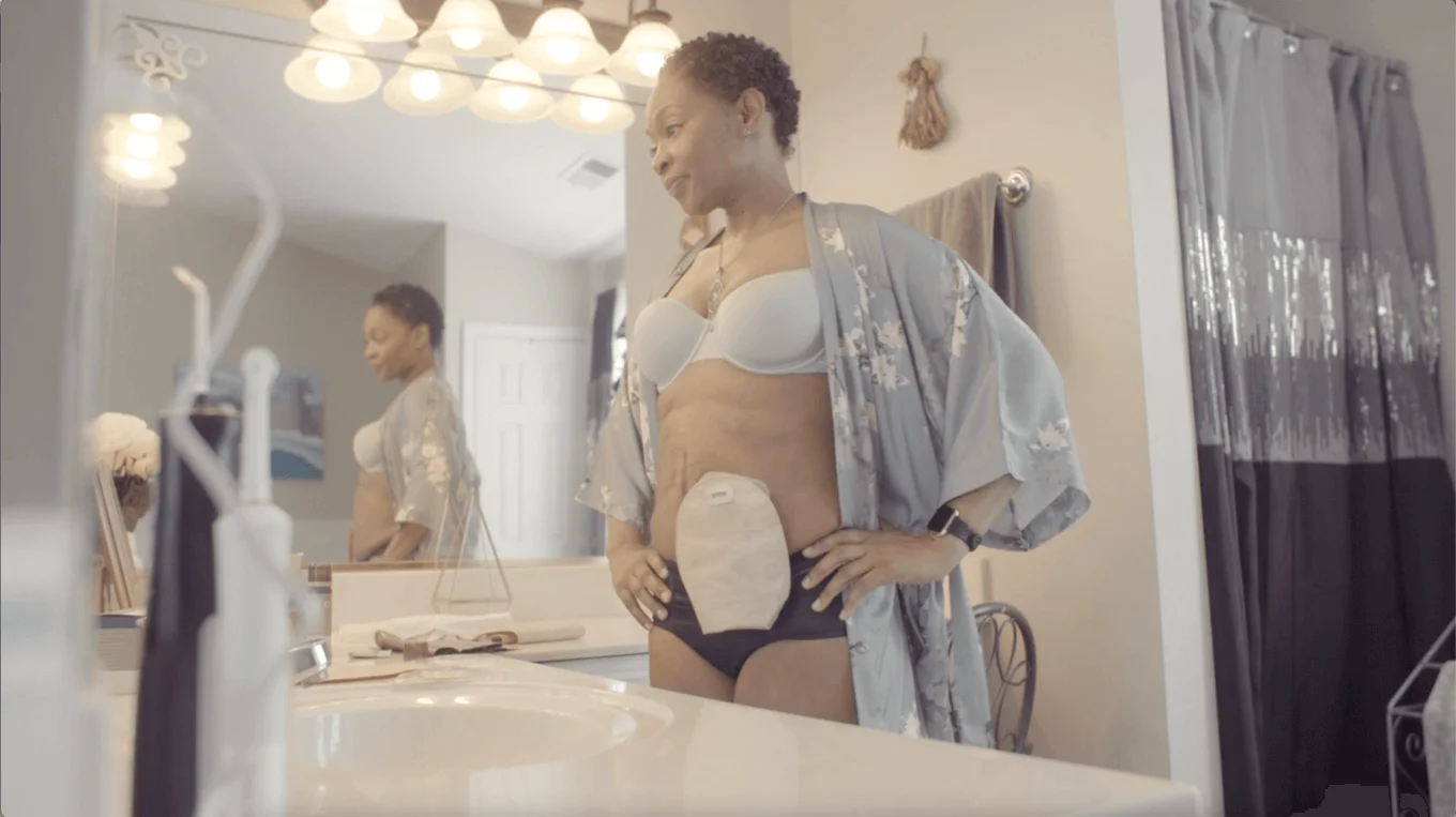 Žena v stomickom vrecku